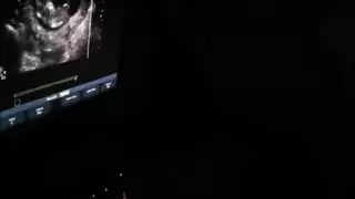 مص ومتعه النيك التايلاندي حامل هيجانه