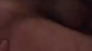 عذراء شعر في الوجه