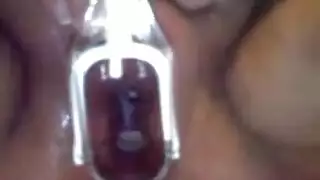 البث المباشر هو الأفضل
